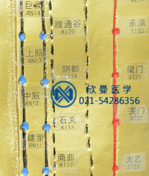 針灸銅人穴位特寫，清晰可見。