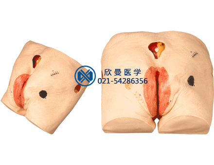 褥瘡護(hù)理模型，壓瘡護(hù)理模型